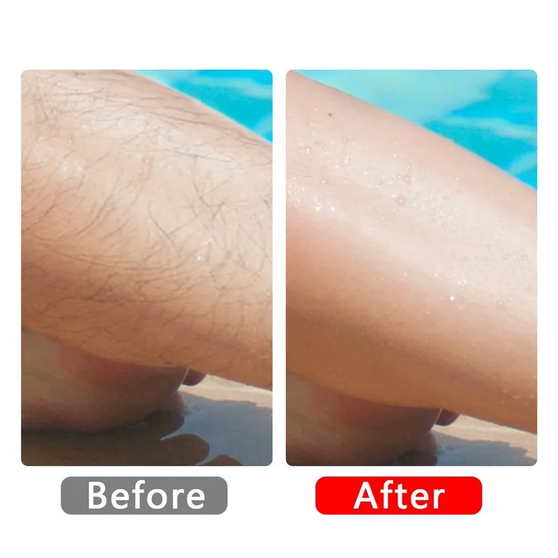 Result of Portable Crystal Hair Remover: Painless Hair Removal Solution for Any Body Part - LoftShop